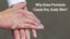 Why Does Psoriasis Cause Dry, Scaly Skin?